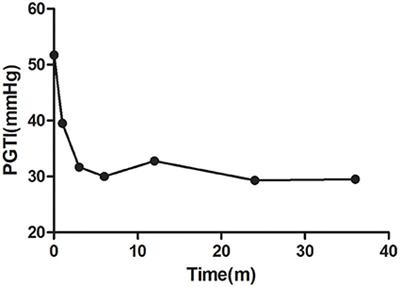 Post-interventional Evaluation and Follow-Up in Children With Patent Ductus Arteriosus Complicated With Moderate to Severe Pulmonary Arterial Hypertension: A Retrospective Study